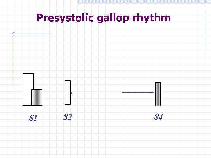 Presystolic gallop rhythm S 1 S 2 S 4 