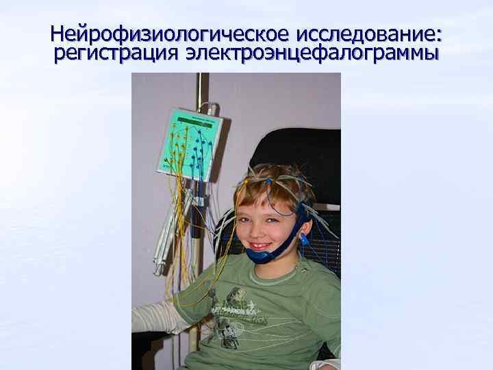 Нейрофизиологическое исследование: регистрация электроэнцефалограммы 
