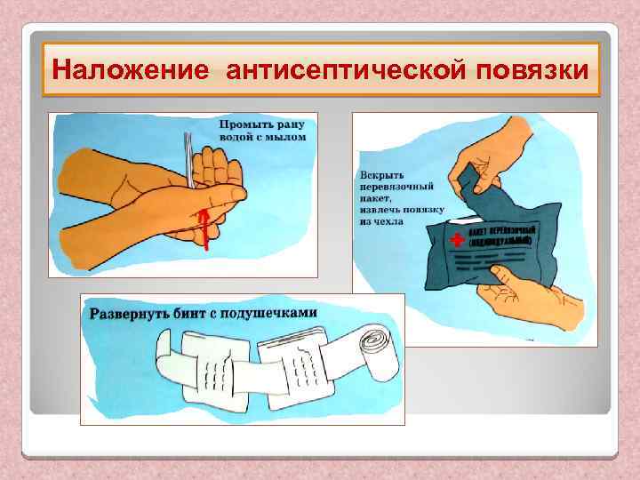 Наложение антисептической повязки 