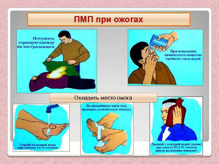 ПМП при ожогах Охладить место ожога 