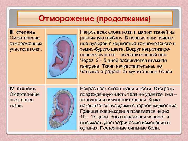 Отморожение (продолжение) ΙΙΙ степень Омертвление отмороженных участков кожи. Некроз всех слоев кожи и мягких