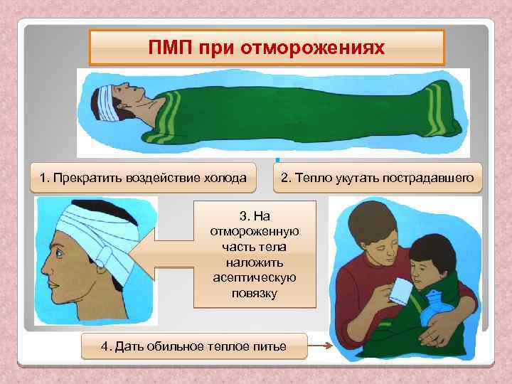 ПМП при отморожениях 1. Прекратить воздействие холода 2. Тепло укутать пострадавшего 3. На отмороженную
