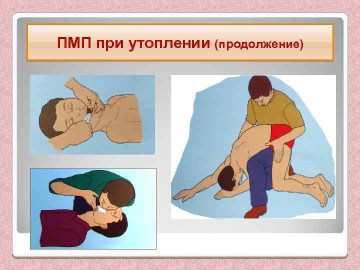 ПМП при утоплении (продолжение) 