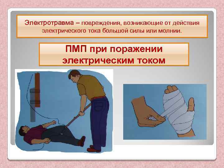 Электротравма – повреждения, возникающие от действия электрического тока большой силы или молнии. ПМП при
