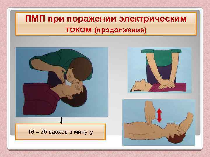ПМП при поражении электрическим током (продолжение) 16 – 20 вдохов в минуту 