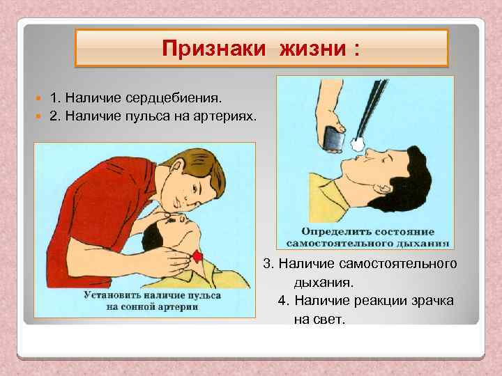 Признаки жизни : 1. Наличие сердцебиения. 2. Наличие пульса на артериях. 3. Наличие самостоятельного