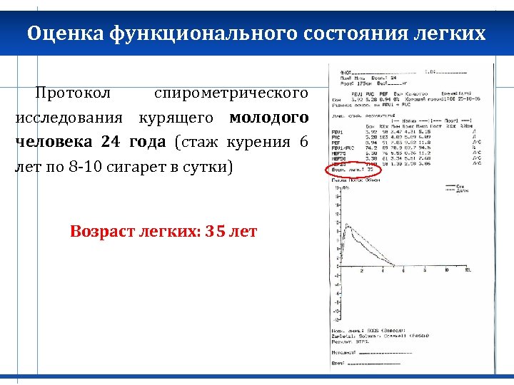 Оценка функционального состояния легких Протокол спирометрического исследования курящего молодого человека 24 года (стаж курения