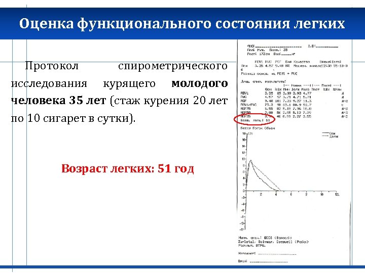 Оценка функционального состояния легких Протокол спирометрического исследования курящего молодого человека 35 лет (стаж курения