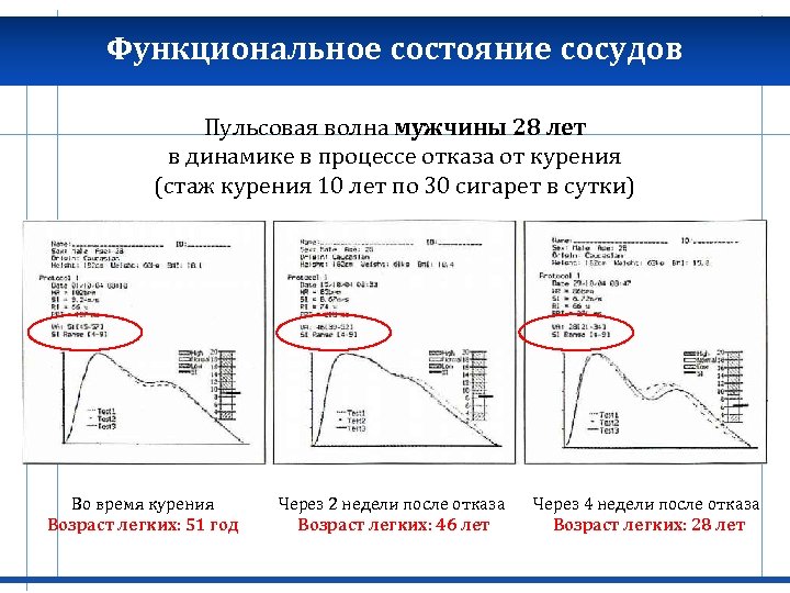 Функциональное состояние сосудов Пульсовая волна мужчины 28 лет в динамике в процессе отказа от
