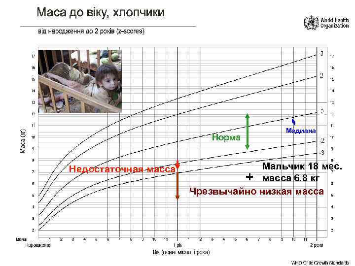 Норма Недостаточная масса Медиана Мальчик 18 мес. + масса 6. 8 кг Чрезвычайно низкая