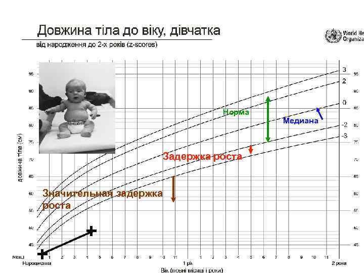 Норма Задержка роста Значительная задержка роста + + Медиана 