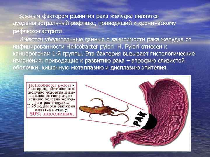  Важным фактором развития рака желудка является дуоденогастральный рефлюкс, приводящий к хроническому рефлюкс-гастрита. Имеются