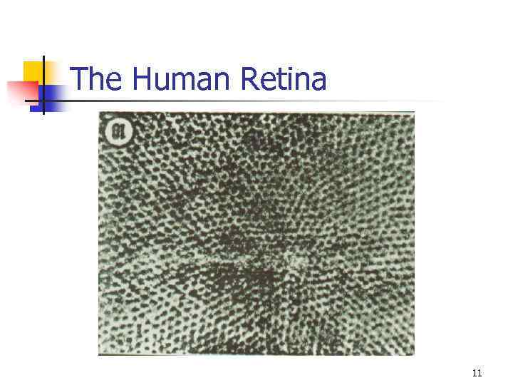 The Human Retina 11 