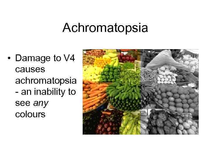 Achromatopsia • Damage to V 4 causes achromatopsia - an inability to see any