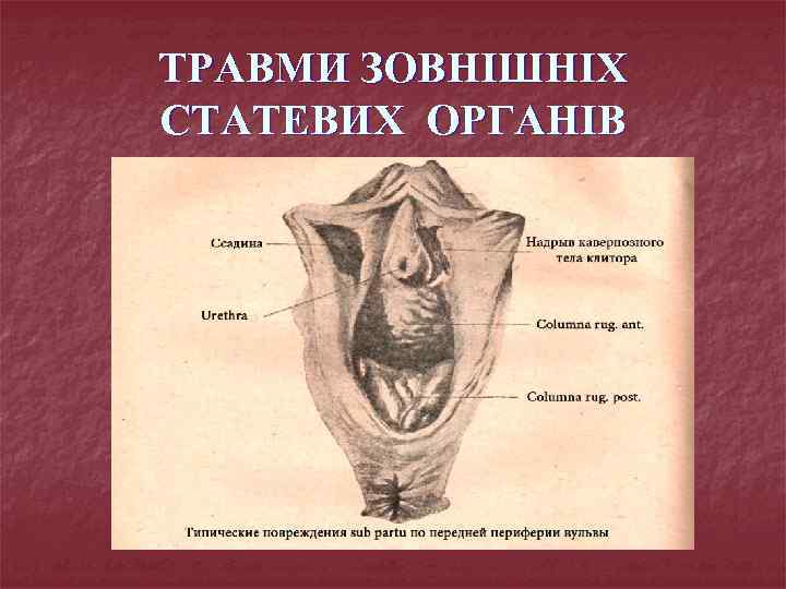 ТРАВМИ ЗОВНІШНІХ СТАТЕВИХ ОРГАНІВ 