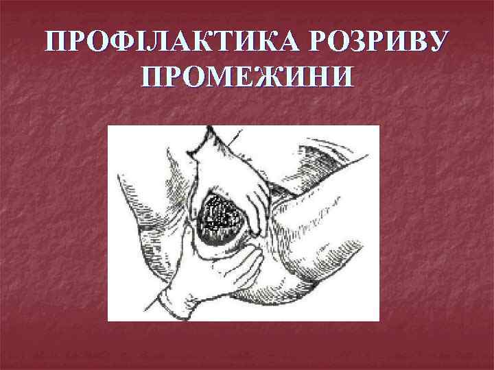 ПРОФІЛАКТИКА РОЗРИВУ ПРОМЕЖИНИ 