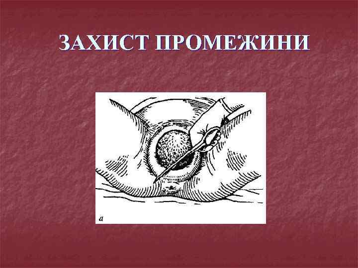 ЗАХИСТ ПРОМЕЖИНИ 