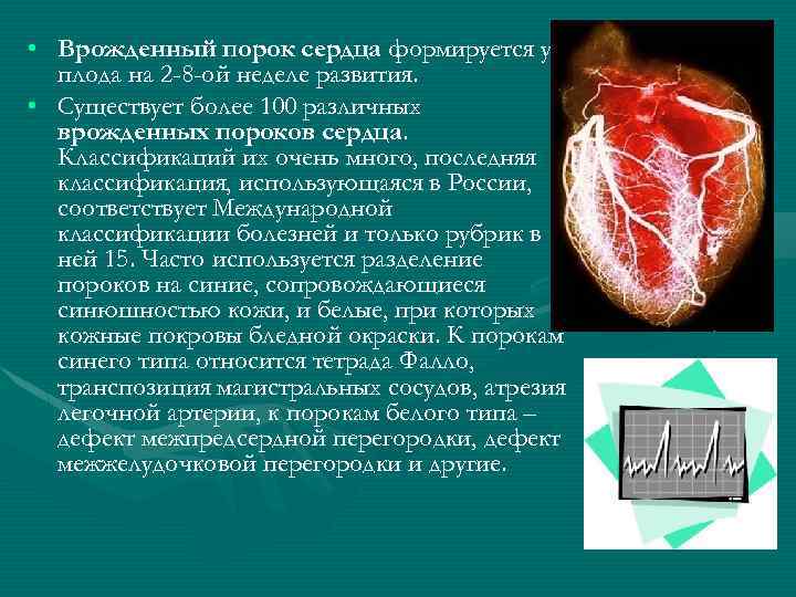  • Врожденный порок сердца формируется у плода на 2 -8 -ой неделе развития.