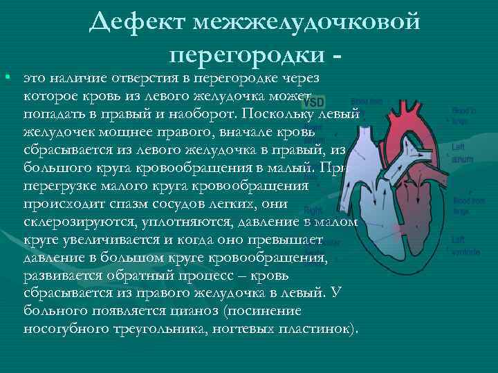 Дефект межжелудочковой перегородки - • это наличие отверстия в перегородке через которое кровь из