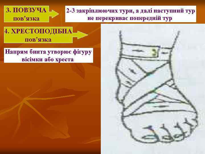 3. ПОВЗУЧА пов'язка 2 -3 закріплюючих тури, а далі наступний тур не перекриває попередній