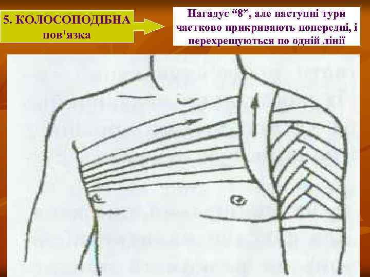 5. КОЛОСОПОДІБНА пов'язка Нагадує “ 8”, але наступні тури частково прикривають попередні, і перехрещуються