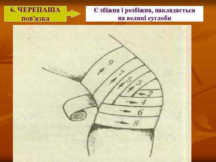 6. ЧЕРЕПАША пов'язка Є збіжна і розбіжна, накладається на великі суглоби 