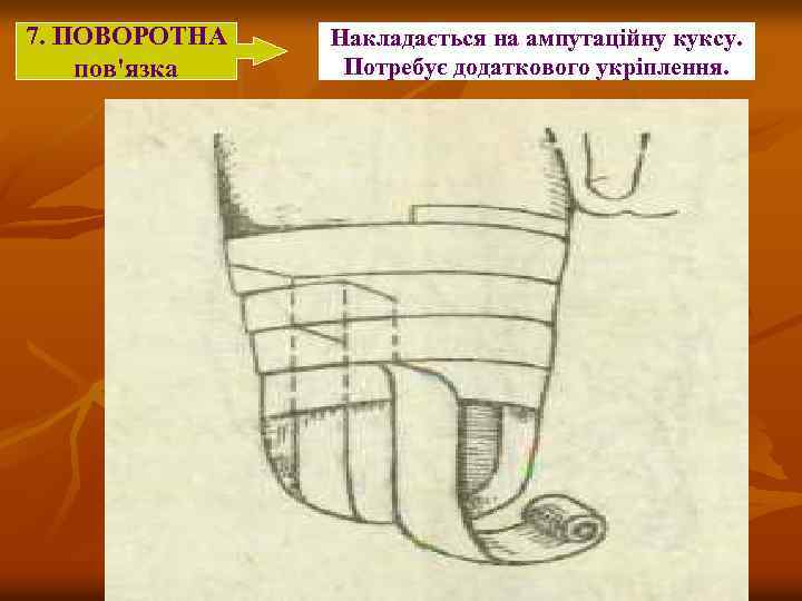 7. ПОВОРОТНА пов'язка Накладається на ампутаційну куксу. Потребує додаткового укріплення. 