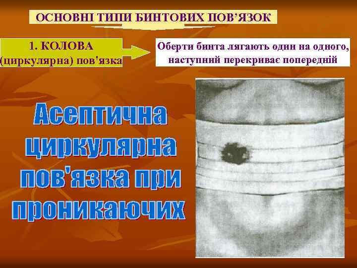 ОСНОВНІ ТИПИ БИНТОВИХ ПОВ’ЯЗОК 1. КОЛОВА (циркулярна) пов'язка Оберти бинта лягають один на одного,