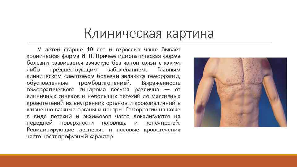 Клиническая картина У детей старше 10 лет и взрослых чаще бывает хроническая форма ИТП.