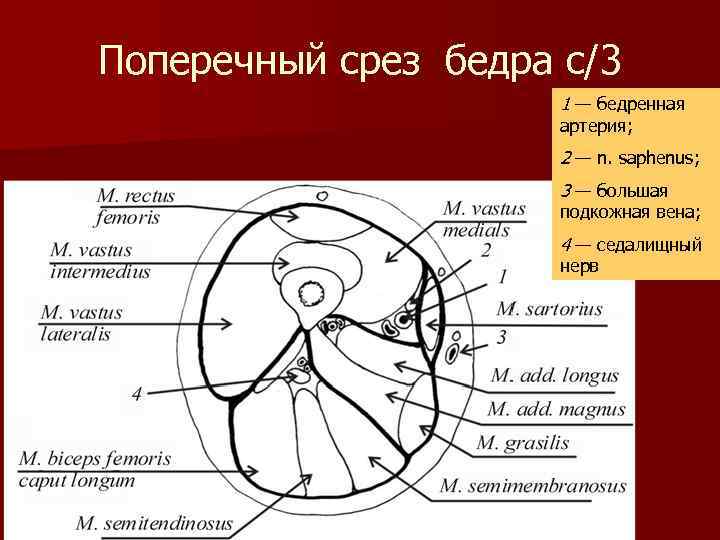 Поперечный срез бедра с/3 1 — бедренная артерия; 2 — n. saрhenus; 3 —