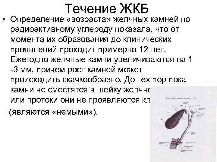 Течение ЖКБ • Определение «возраста» желчных камней по радиоактивному углероду показала, что от момента