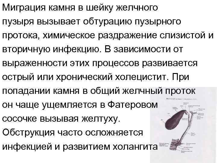 Миграция камня в шейку желчного пузыря вызывает обтурацию пузырного протока, химическое раздражение слизистой и