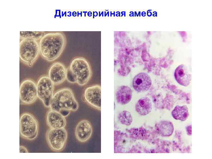 Дизентерийная амеба 