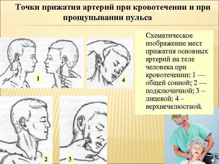 Как производится пальцевое прижатие подключичной артерии