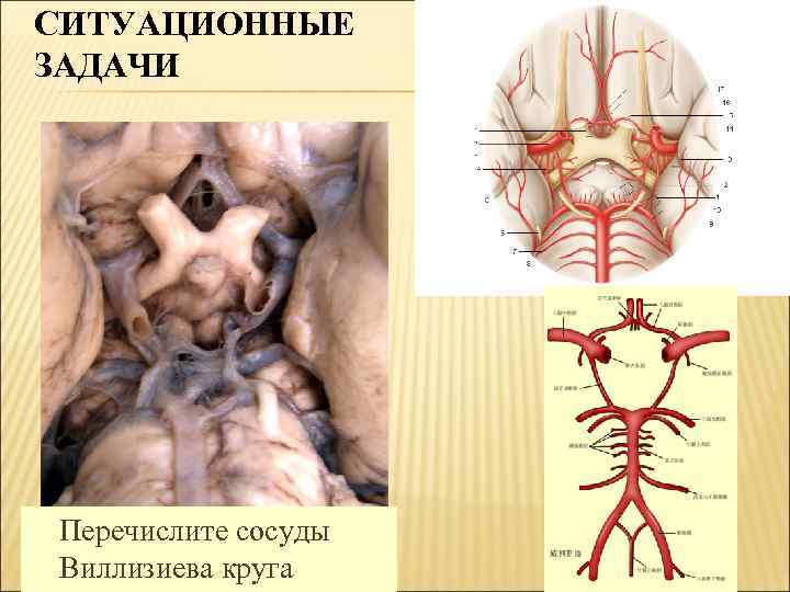 СИТУАЦИОННЫЕ ЗАДАЧИ Перечислите сосуды Виллизиева круга 