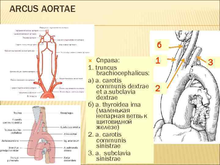 ARCUS AORTAE б Cправа: 1. truncus brachiocephalicus: а) a. carotis communis dextrae et a.