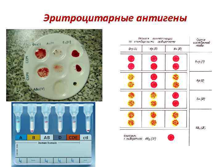 Эритроцитарные антигены 