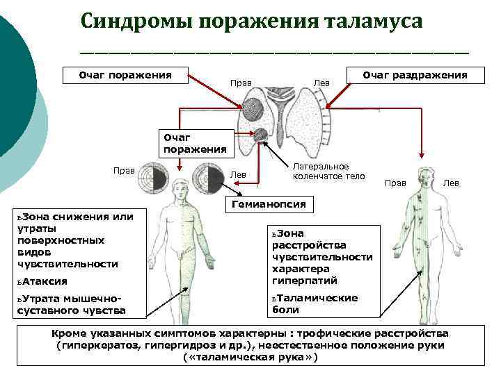 Синдромы поражения таламуса ___________________________ Очаг поражения Прав Лев Очаг раздражения Очаг поражения Прав Лев