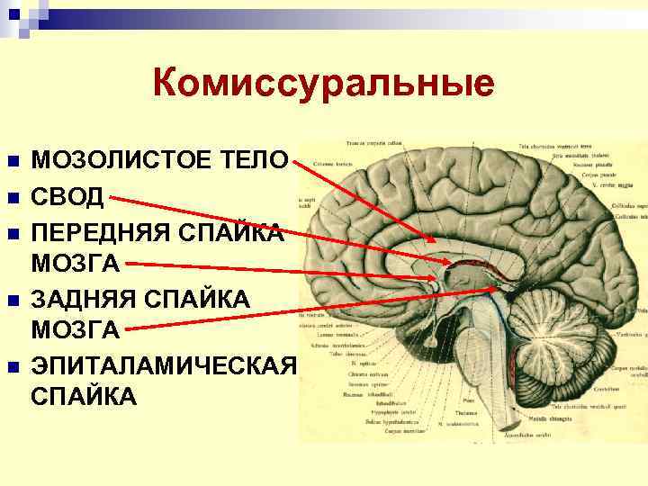 Свод головного мозга. Строение свода конечного мозга. Свод мозга строение анатомия. Передняя спайка конечного мозга. Спайки головного мозга свода.