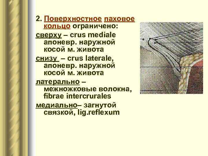 2. Поверхностное паховое кольцо ограничено: сверху – crus mediale апоневр. наружной косой м. живота