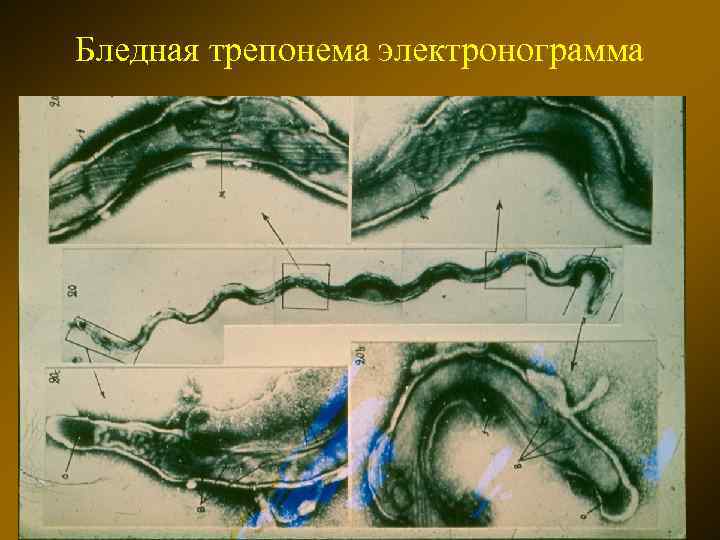 Заболевания вызываемые трепонемой. Спирохета бледная трепонема. Treponema pallidum строение. Бледная спирохета микробиология.