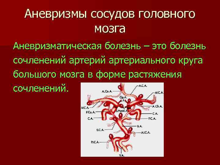 Презентация аневризмы сосудов головного мозга