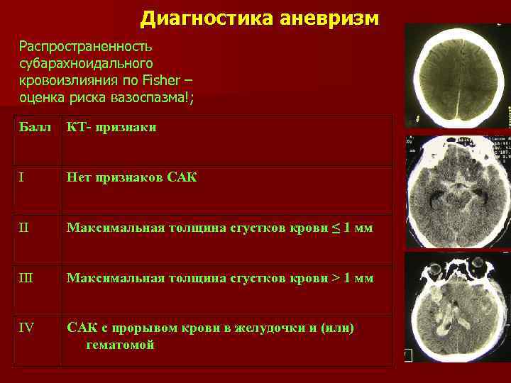 Диагностика аневризм Распространенность субарахноидального кровоизлияния по Fisher – оценка риска вазоспазма!; Балл КТ- признаки