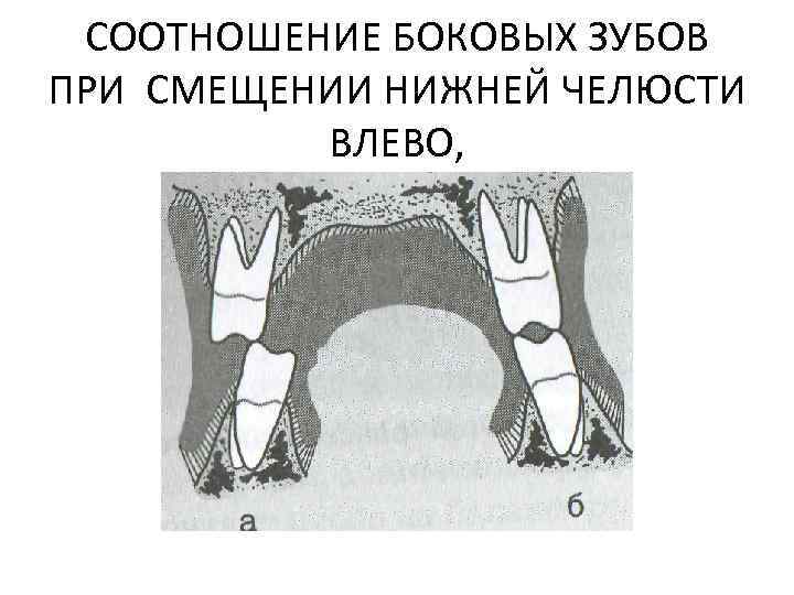 Презентация биомеханика нижней челюсти