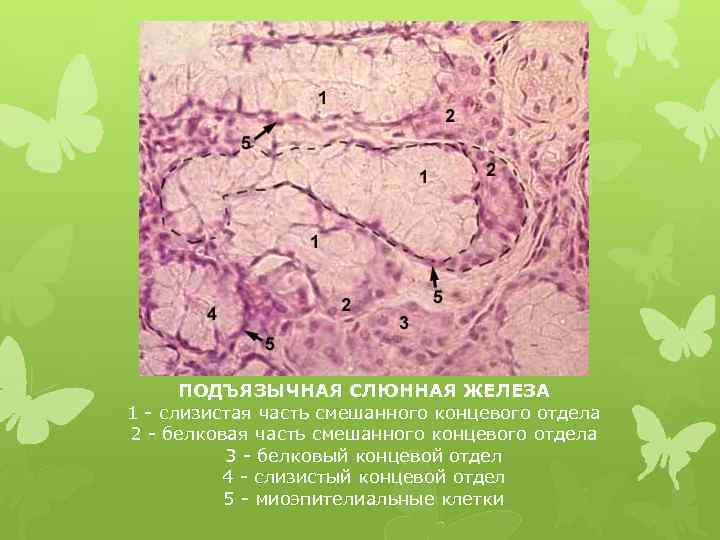 ПОДЪЯЗЫЧНАЯ СЛЮННАЯ ЖЕЛЕЗА 1 - слизистая часть смешанного концевого отдела 2 - белковая часть