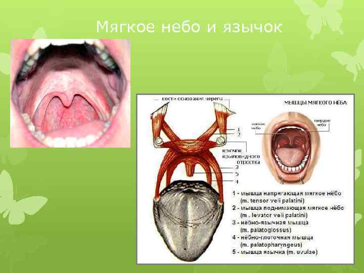 Мягкое небо и язычок 