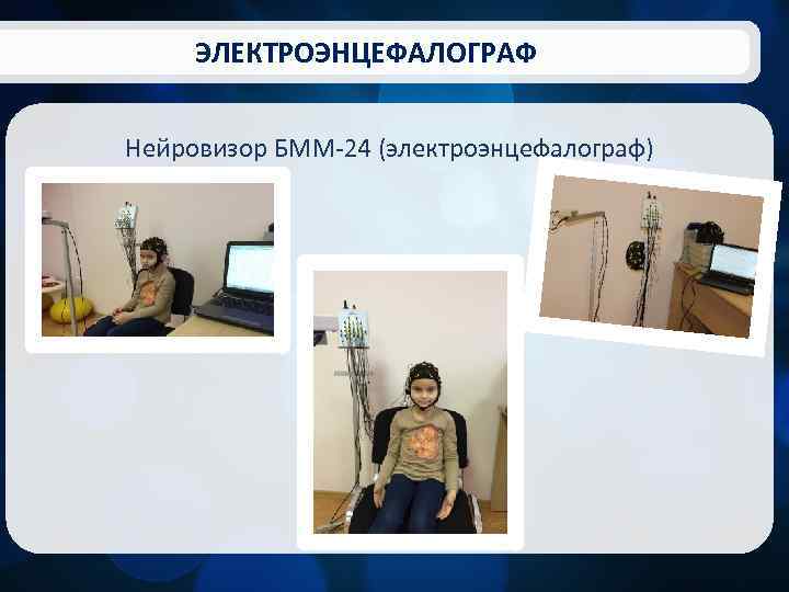 ЭЛЕКТРОЭНЦЕФАЛОГРАФ Нейровизор БММ-24 (электроэнцефалограф) 