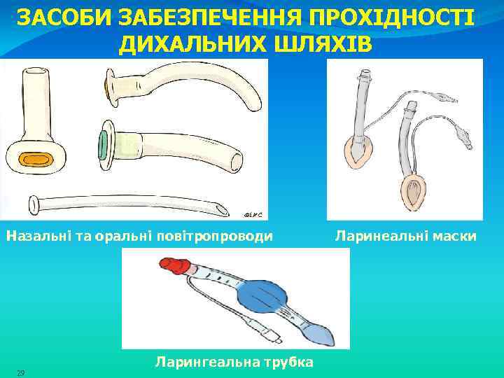 ЗАСОБИ ЗАБЕЗПЕЧЕННЯ ПРОХІДНОСТІ ДИХАЛЬНИХ ШЛЯХІВ Назальні та оральні повітропроводи 29 Ларингеальна трубка Ларинеальні маски