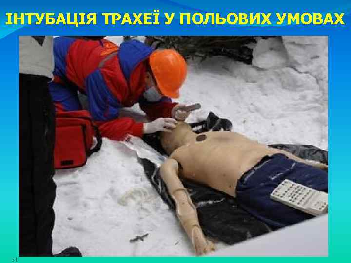 ІНТУБАЦІЯ ТРАХЕЇ У ПОЛЬОВИХ УМОВАХ 31 