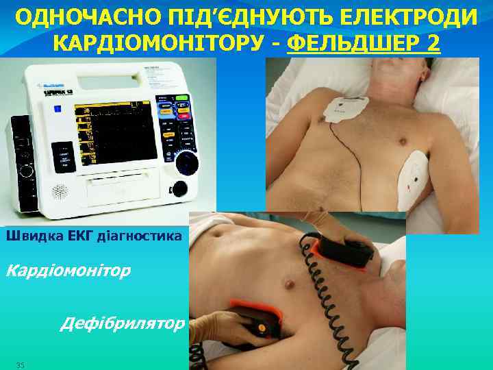 ОДНОЧАСНО ПІД’ЄДНУЮТЬ ЕЛЕКТРОДИ КАРДІОМОНІТОРУ - ФЕЛЬДШЕР 2 Швидка ЕКГ діагностика Кардіомонітор Дефібрилятор 35 